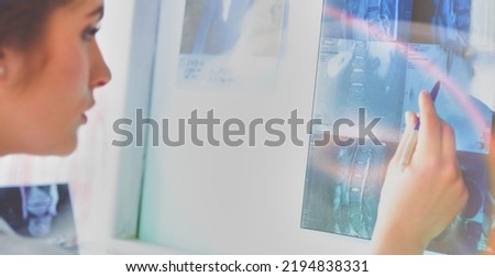 Young female doctor looking at the x-ray picture of lungs in hospital