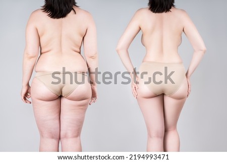 Woman's body before and after weight loss or liposuction on gray background, fat and thin female back and buttocks, plastic surgery concept