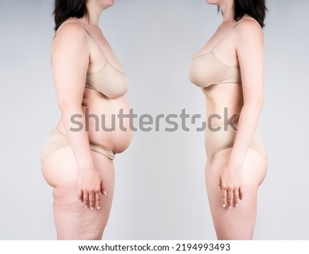 Woman's body before and after weight loss or liposuction on gray background, plastic surgery concept