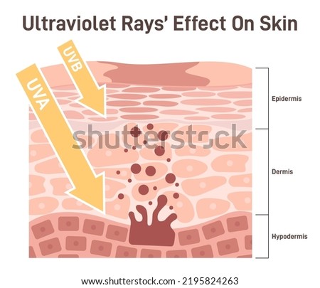 How UV rays effect on skin. UVA, UVB rays go through the skin cells to hypodermis producing melanin. Flat vector illustration Royalty-Free Stock Photo #2195824263