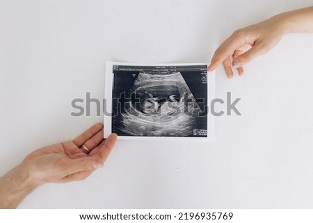Couple parents holds ultrasound snapshot their future baby in womb. Concept of love and care during pregnancy, expecting and born baby.
