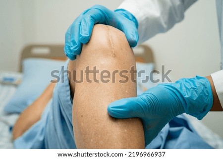 Asian senior or elderly old lady woman patient show her scars surgical total knee joint replacement Suture wound surgery arthroplasty on bed in nursing hospital ward, healthy strong medical concept. Royalty-Free Stock Photo #2196966937