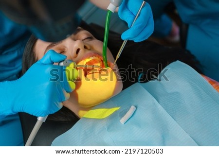 Dentist uses photopolymer lamp to cure carious teeth of the female patient in dentist office
