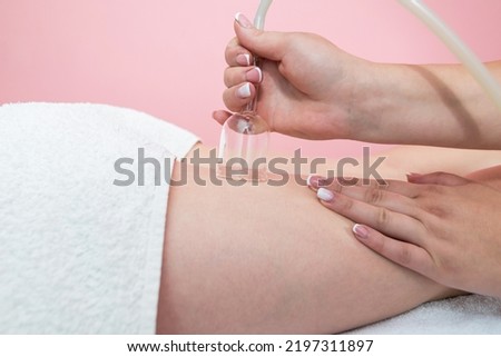 Hardware cosmetology. Vacuum massage procedure in a medical beauty center. Close-up of a young woman's anti-cellulite cupping therapy. Royalty-Free Stock Photo #2197311897