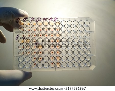 TPHA Enzyme-linked immunosorbent assay (ELISA) plate, Immunology or serology testing method in medical laboratory Royalty-Free Stock Photo #2197391967