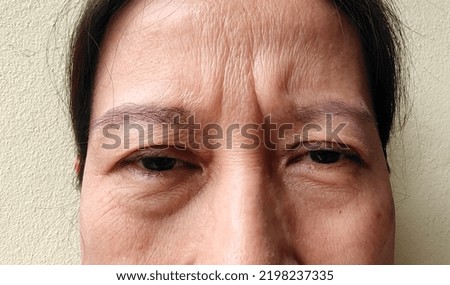 portrait showing the flabbiness adipose sagging skin, Flabby and dark spots on the face, cellulite under the eyes, forehead lines on the face, problem wrinkled and aged of the Middle-aged woman. Royalty-Free Stock Photo #2198237335