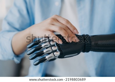 Women with disability turns on her lightweight bionic prosthesis of arm. Female with disability using robotic hand after limb loss. Advertising of high tech artificial limbs. Medical technologies. Royalty-Free Stock Photo #2198803689