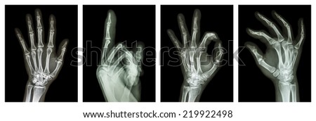 Collection X-ray symbol hands