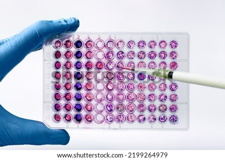 Researcher experimenting with a diagnostic plate in wells with culture medium. Scientist pipetting biological samples of cells into a 96-well microplate Royalty-Free Stock Photo #2199264979