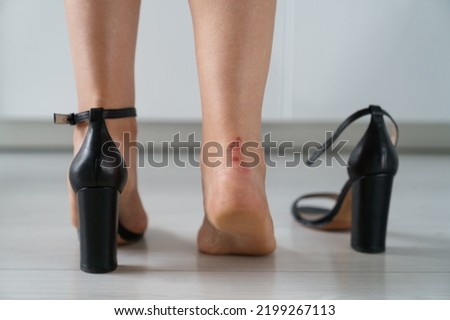 Woman feet in pain after wearing high heeled shoes after walking, closeup back view. touching the painful sore on her leg with her fingers. Tired female takes off tight shoes after work at home.  Royalty-Free Stock Photo #2199267113