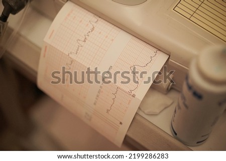 Vital Sign Print Paper in Recovery Room                 