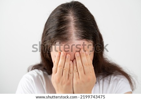 Close up of hair loss woman stressed and crying over rapid hair loss against white background Royalty-Free Stock Photo #2199743475