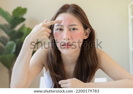 Dermatology, puberty asian young woman, girl looking into mirror, allergy presenting an allergic reaction from cosmetic, red spot or  rash on face. Beauty care from skin problem by medical treatment. Royalty-Free Stock Photo #2200179783