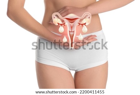 Woman holding virtual image of female reproductive system on white background. Vaginal yeast infection Royalty-Free Stock Photo #2200411455