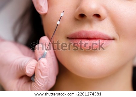 Face lifting PDO Suture operation. innovative technique of New thread lift, cosmetologist preparing to do procedure to female client, select the appropriate thread option Royalty-Free Stock Photo #2201274581