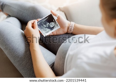 Pregnant woman with ultrasound image on sofa, top view. Concept expectant mother waiting for baby birth during pregnancy, light background. Royalty-Free Stock Photo #2201539441