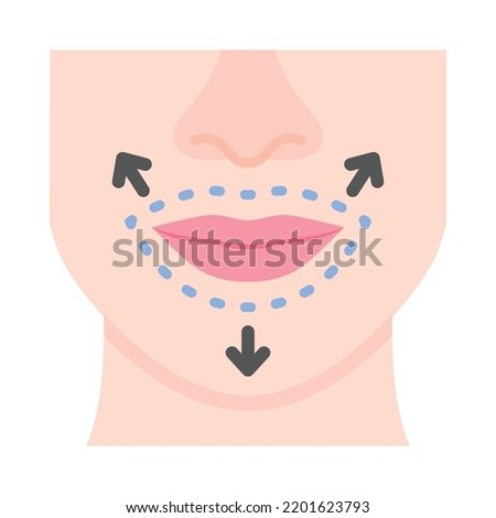 Lips surgery flat design.  Cosmetic surgery on lips with dotted lines. For plastic surgery clinic, medical and beauty publications. Vector Illustration. Royalty-Free Stock Photo #2201623793