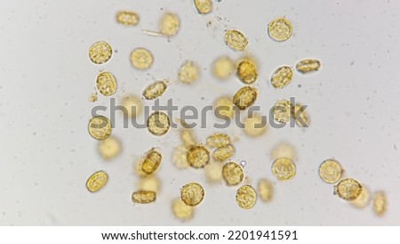 Marine diatom called Cyclotella. 400x magnification with selective focus Royalty-Free Stock Photo #2201941591