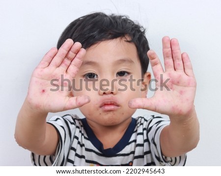 sick child raising both hands pain with hand, foot and mouth disease viral infection isolated Royalty-Free Stock Photo #2202945643