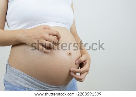 Pregnant women have itchy skin, which is the cause of pregnant women's problem stripes. Royalty-Free Stock Photo #2203591599