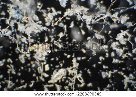 House dust and mites observed under a microscope Royalty-Free Stock Photo #2203690345