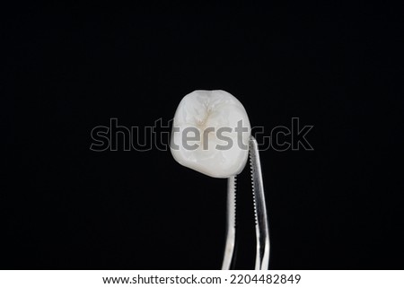 Porcelain Veneers Crown Ceramic Teeth Tooth Dental dentist beautiful Royalty-Free Stock Photo #2204482849