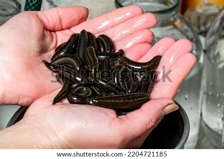 Many leeches in hand on laboratory. Medical leeches for hirudo therapy Royalty-Free Stock Photo #2204721185