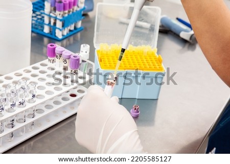 Scientist preparing bone marrow samples for flow cytometric analysis in the laboratory. Royalty-Free Stock Photo #2205585127