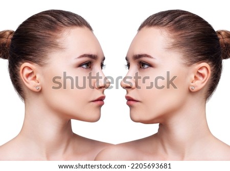 Young woman before and after chin correction. slimming concept. Over white background. Royalty-Free Stock Photo #2205693681