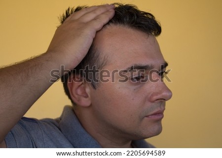 Image of a man showing the onset of hair loss and the principle of receding hairline. Possible causes and remedies for hair loss
 Royalty-Free Stock Photo #2205694589