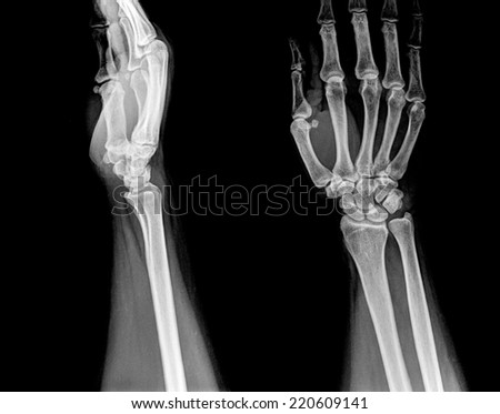 X-ray of human hands.