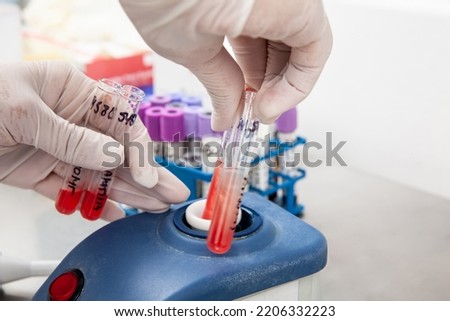 Scientist using a vortex to mix contents in a test tube. Scientist preparing bone marrow samples for flow cytometric analysis in the laboratory. Royalty-Free Stock Photo #2206332223