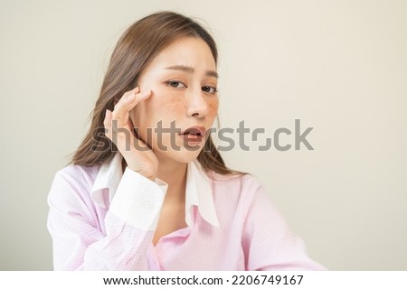 Dermatology, expression face worry, stressed asian young woman hand touching facial at dark spot of melasma, freckles from pigment melanin, allergy sun. Beauty care, skin problem treatment, skincare. Royalty-Free Stock Photo #2206749167