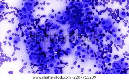 Amelanotic melanoma cytology from dog aspirate Royalty-Free Stock Photo #2207715239