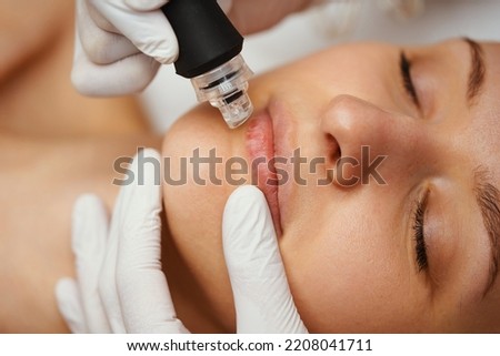 A cosmetologist performs hydropiling in a beauty salon. Skin care. High quality photo