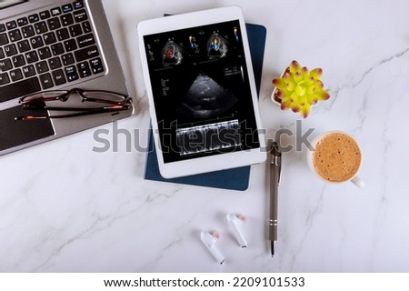 A doctor using a digital tablet examines the results echocardiography ultrasound of heart examination in order prescribe effective treatment to patient Royalty-Free Stock Photo #2209101533