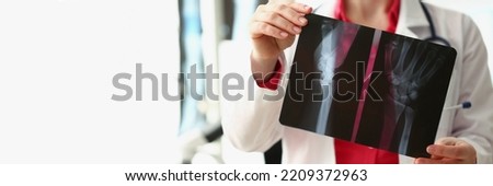 Medical worker analyzing patient hand xray result, injury