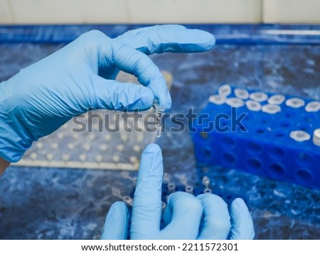 The scientist shows a small test tube with PCR samples for amplification against the background of a rack of test tubes with reagents.