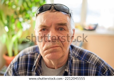 Aged man with facial nerve paralysis, Bell's palsy. Royalty-Free Stock Photo #2212045555