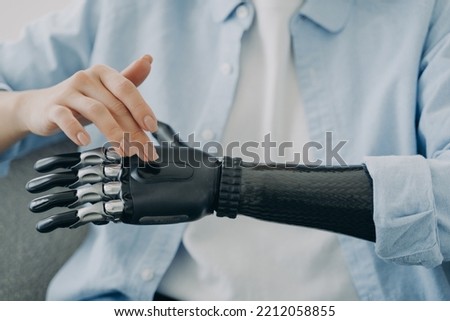 Woman with a disability turns on her sensory bionic hand prosthesis, close up. Female with disability touches artificial robotic prosthetic arm. People with disabilities and high tech medical care Royalty-Free Stock Photo #2212058855