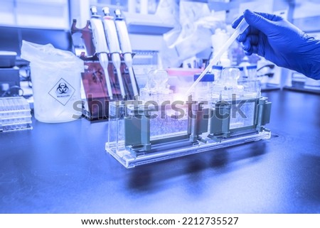 Western blot analysis use as protein analysis for protein detection. This technique use in medical or research laboratory. Also, the method detect HIV infection and cancer biology. Royalty-Free Stock Photo #2212735527