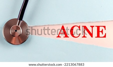 ACNE word made on a torn paper, medical concept background