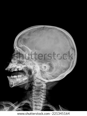Detail of neck and head when open mouth x-ray image.
