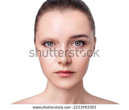 Young woman with bald eyebrows before and after hair transplantation. Alopecia concept. Royalty-Free Stock Photo #2213983301