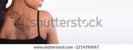Laser Tattoo Removal Before And After. African Woman Royalty-Free Stock Photo #2214390067