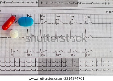 Electrocardiogram showing a supraventricular tachycardia and colored pills. Medical desk concept or flat lay. Royalty-Free Stock Photo #2214394701