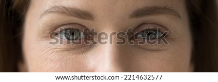 Cropped image, horizontal view female eyes look at camera. Eye-care, eyesight regular check up professional services clinic ad, lenses and eyewear store advertisement, laser surgery, vision correction Royalty-Free Stock Photo #2214632577