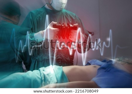 Doctor Professor holding paddles and about to perform CPR on a patient using a defibrillator. Royalty-Free Stock Photo #2216708049
