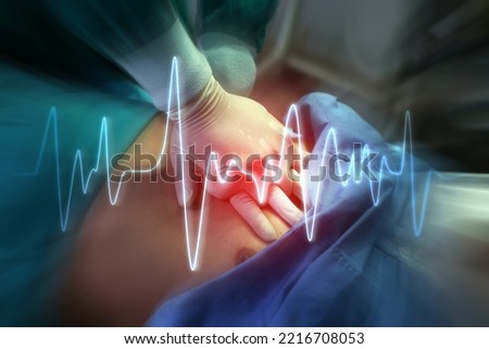 Hands of Doctor perform CPR on a patient in opertion room. Royalty-Free Stock Photo #2216708053