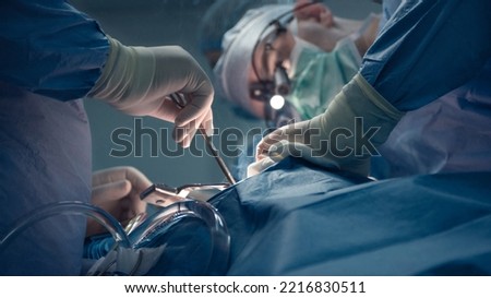 Unrecognizable medic holding instruments while another anonymous medic in mask and glasses performs abdominal surgical procedure in his gloves shot in blue colors and shallow depth of field